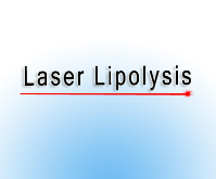 Laser Lipolysis